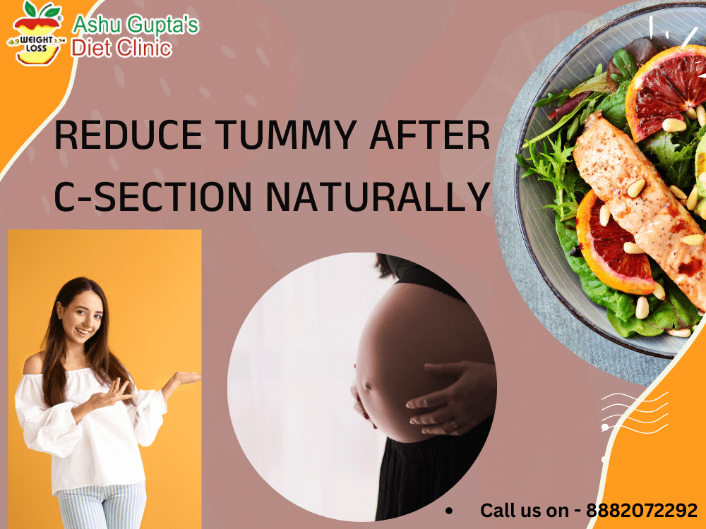 how to reduce tummy after c-section 
