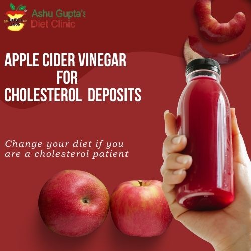 Apple Cider Vinegar for Cholesterol 