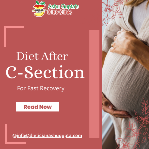 What to Eat After C-Section for Fast Recovery